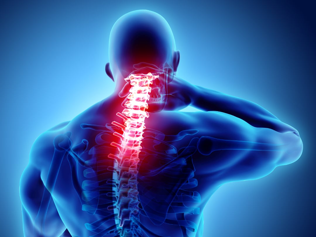 Bolest krcnej chrbtice